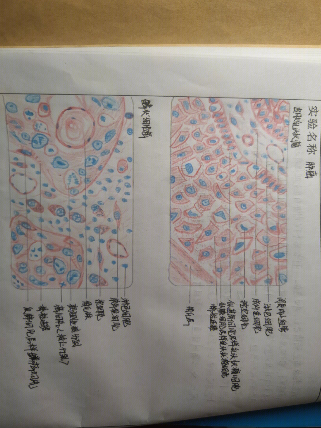幼稚淋巴细胞手绘图图片