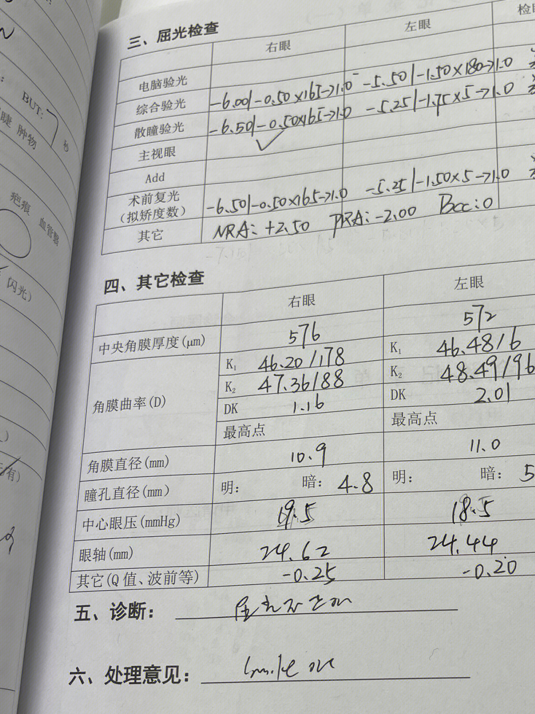 儿童角膜边缘灰色月牙图片