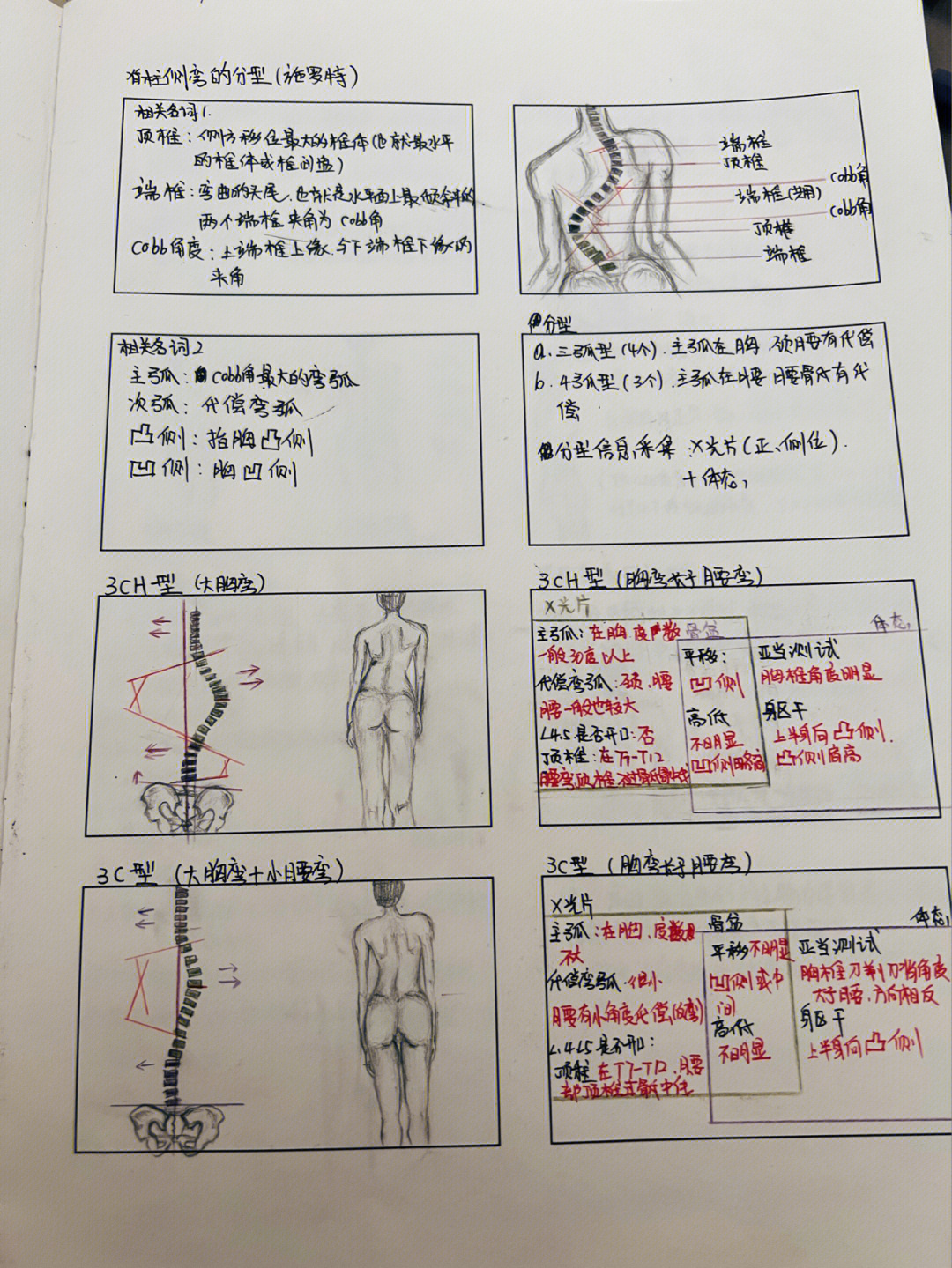 脊柱侧弯lenke分型图谱图片