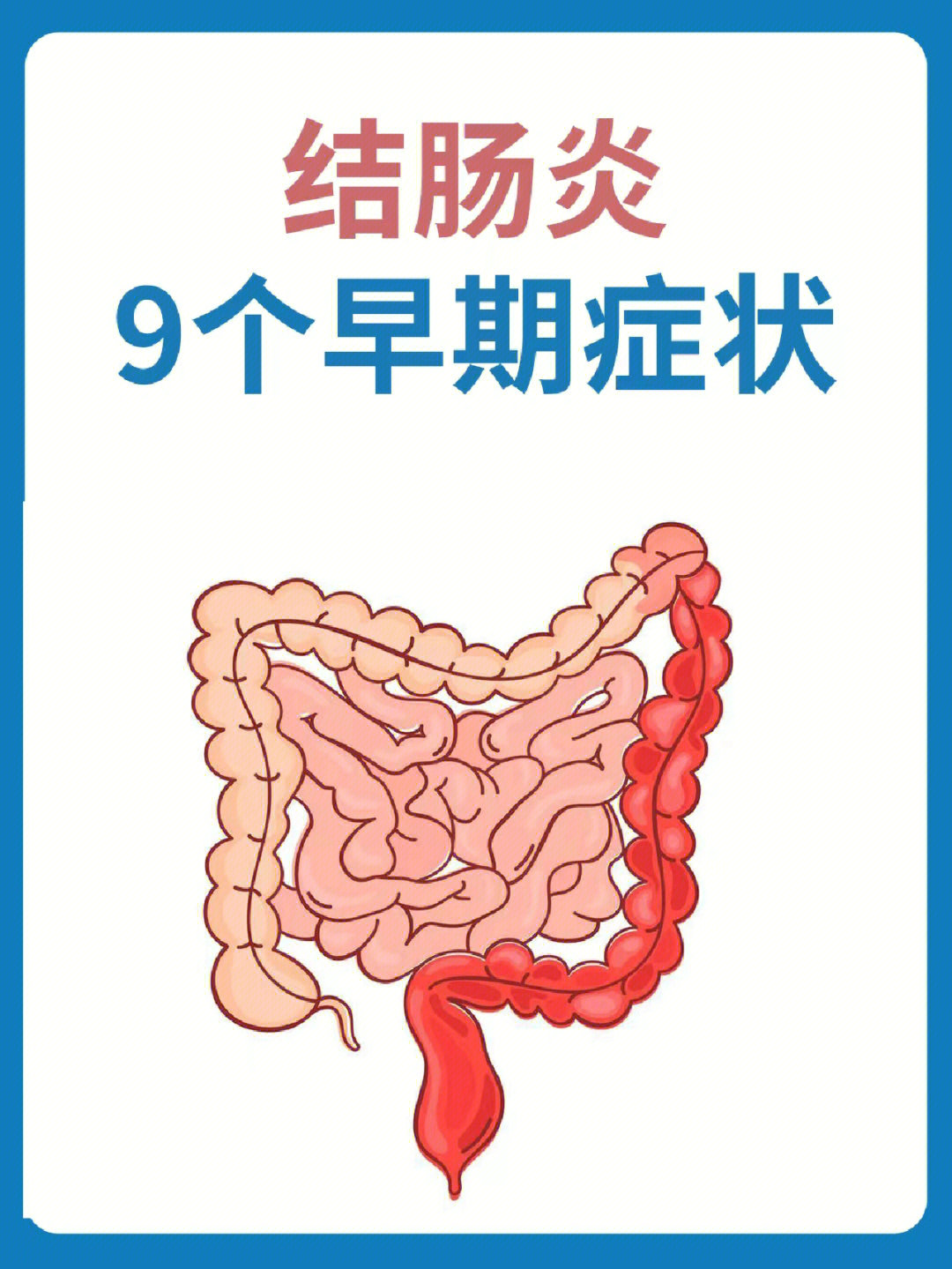 结肠炎的966个早期症状千万别忽视60