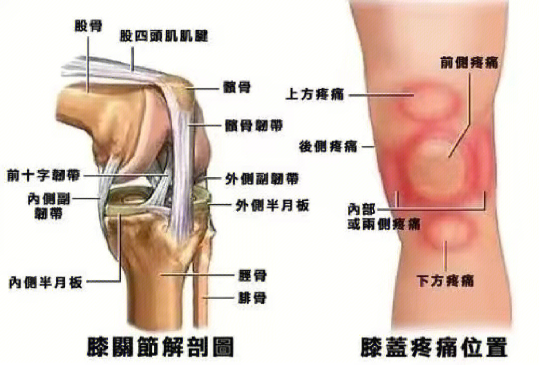 髌前滑囊炎图片