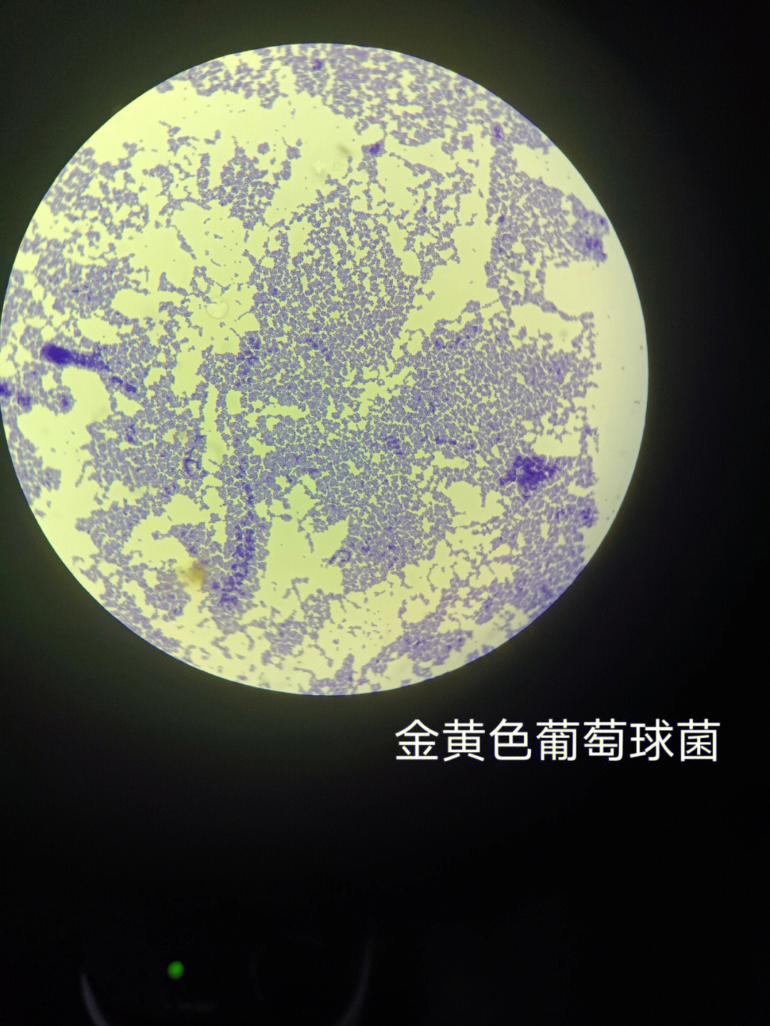 金黄色葡萄球菌乙型链球菌肺炎球菌淋球菌脑炎球菌
