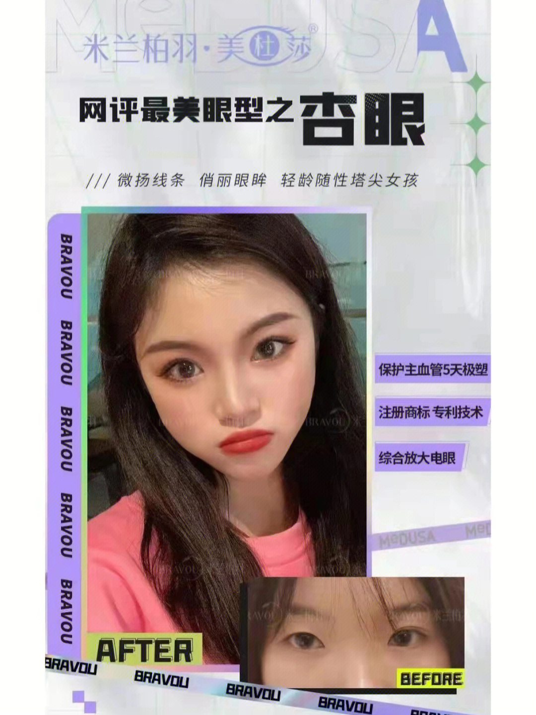 美杜莎双眼皮网评四种最美眼型73