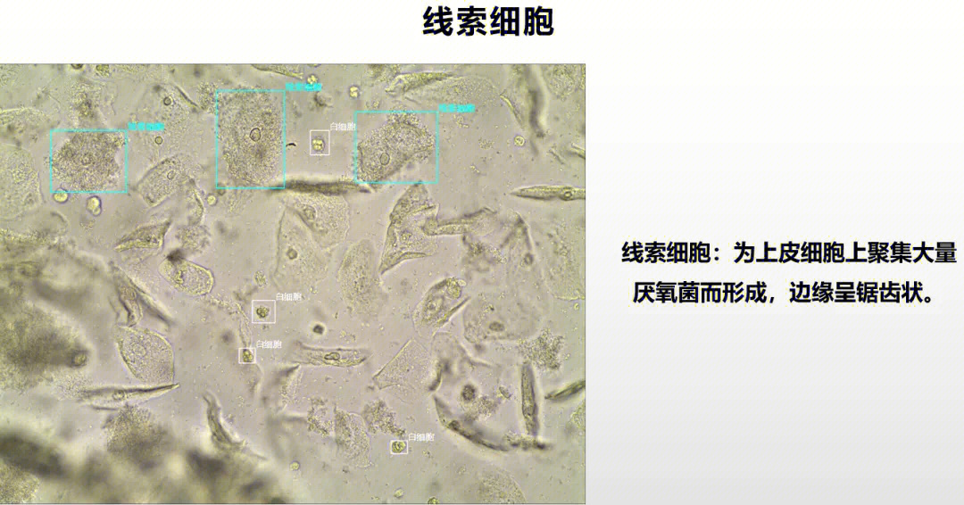 白带显微镜图解图片