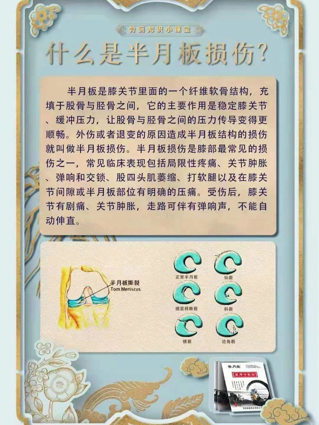 半月板损伤的原因图片