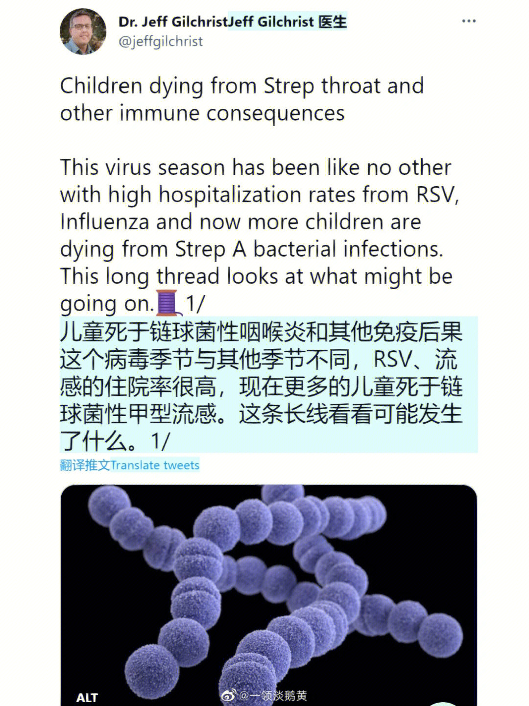 新冠病毒英文简称图片