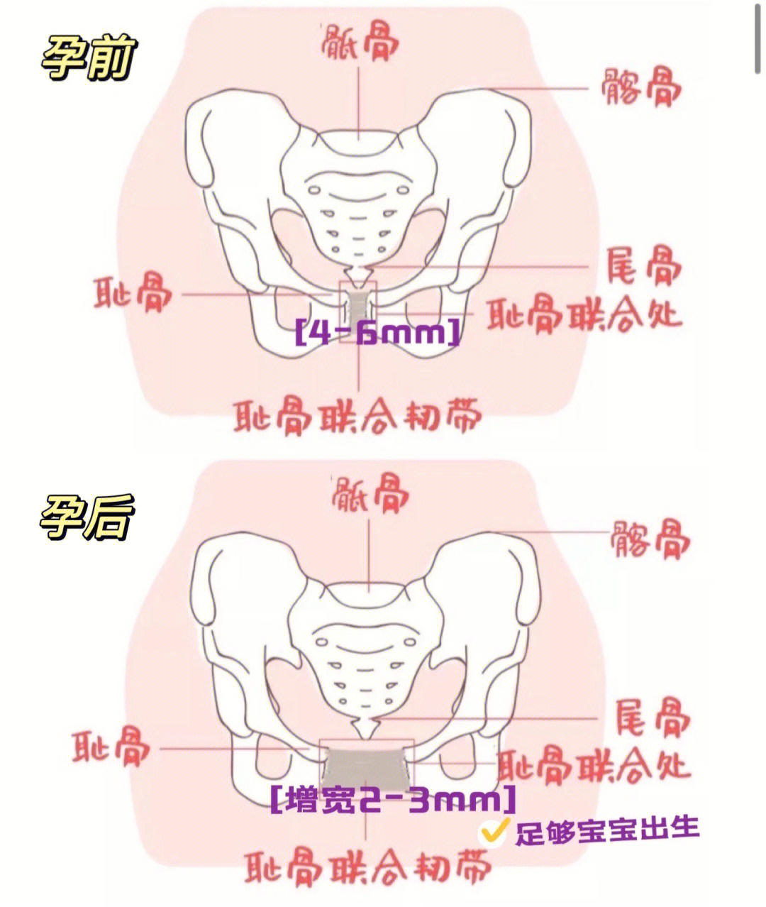 骨盆长度图片