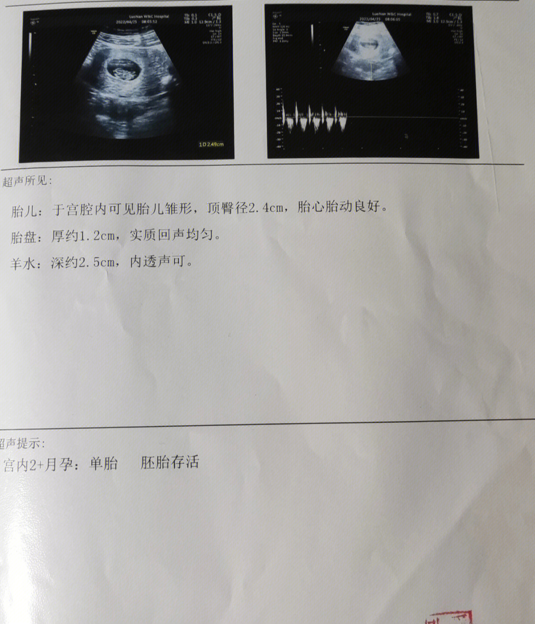 一般男宝的胎心是多少图片