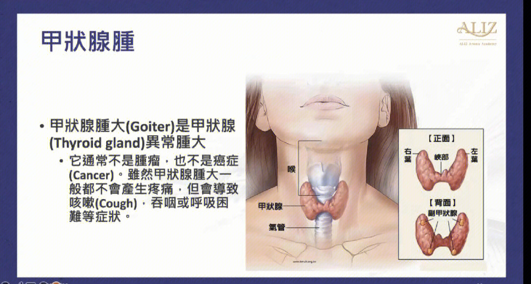 甲状腺结节疗法图片