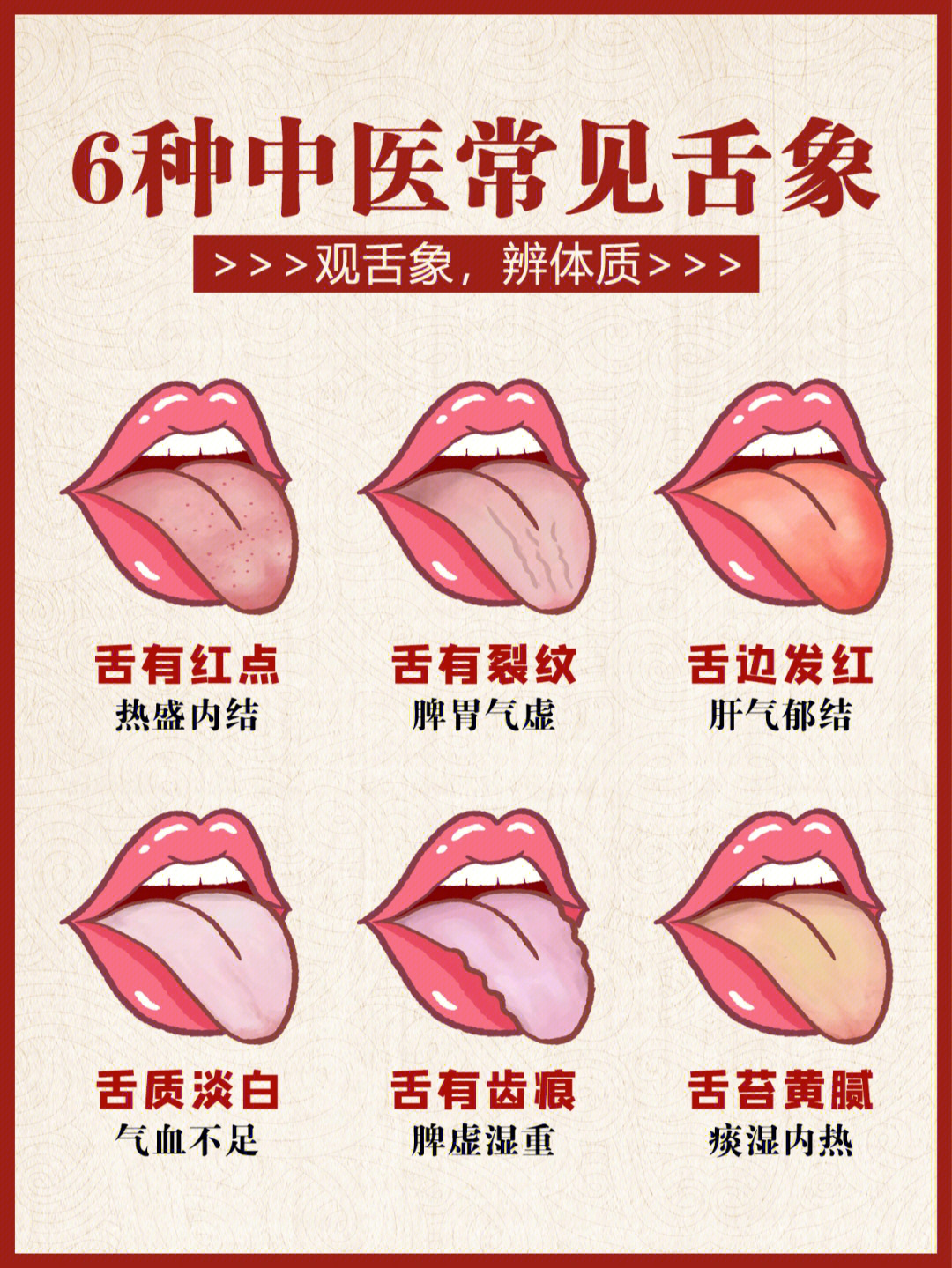 中医看舌苔图片与疾病图片