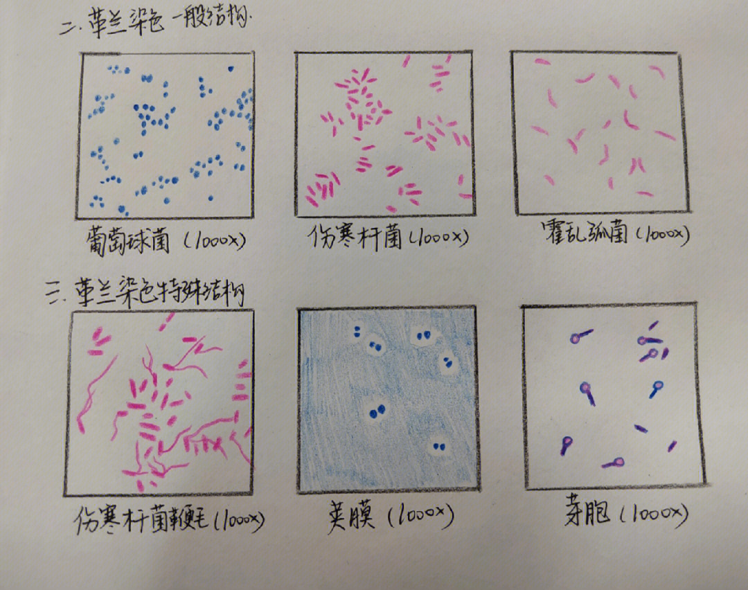 鼠疫杆菌衰残型手绘图图片