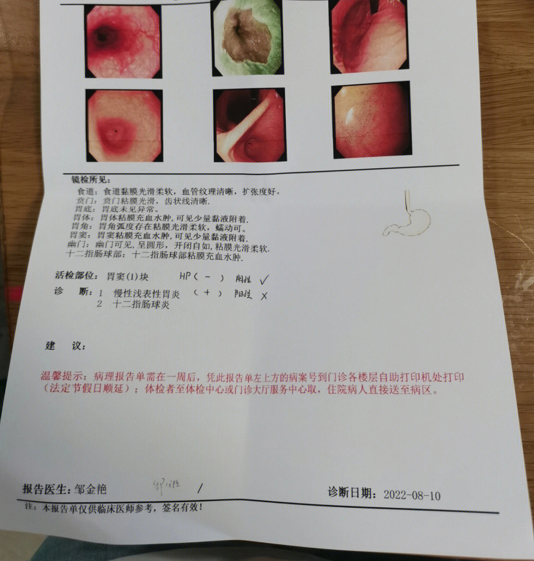 12指肠球炎图片