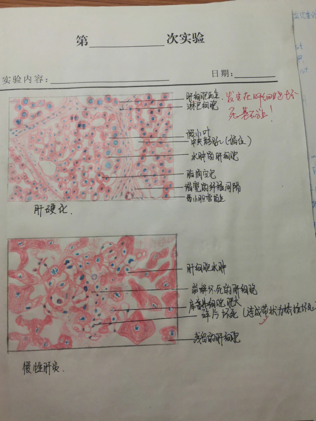 纤维肉瘤的红蓝铅笔图图片