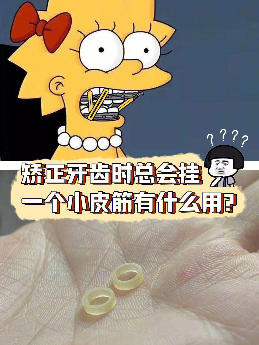 正畸皮筋的作用图片