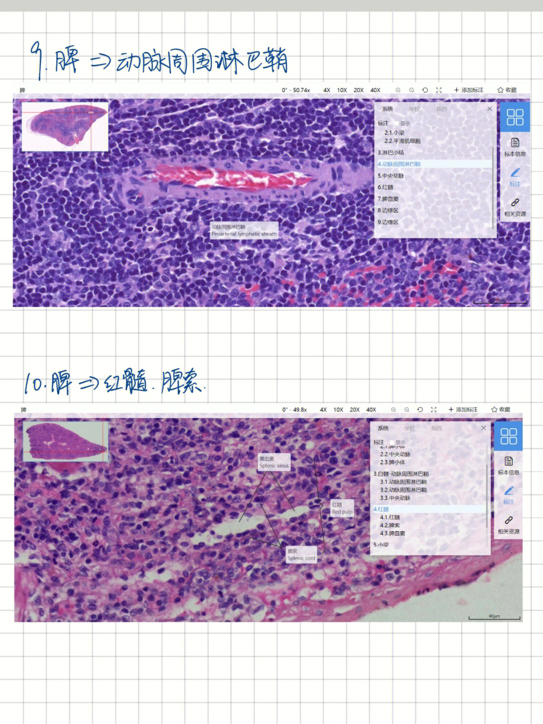 汗腺组胚图片