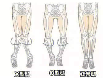 如何判断自己的腿型图片