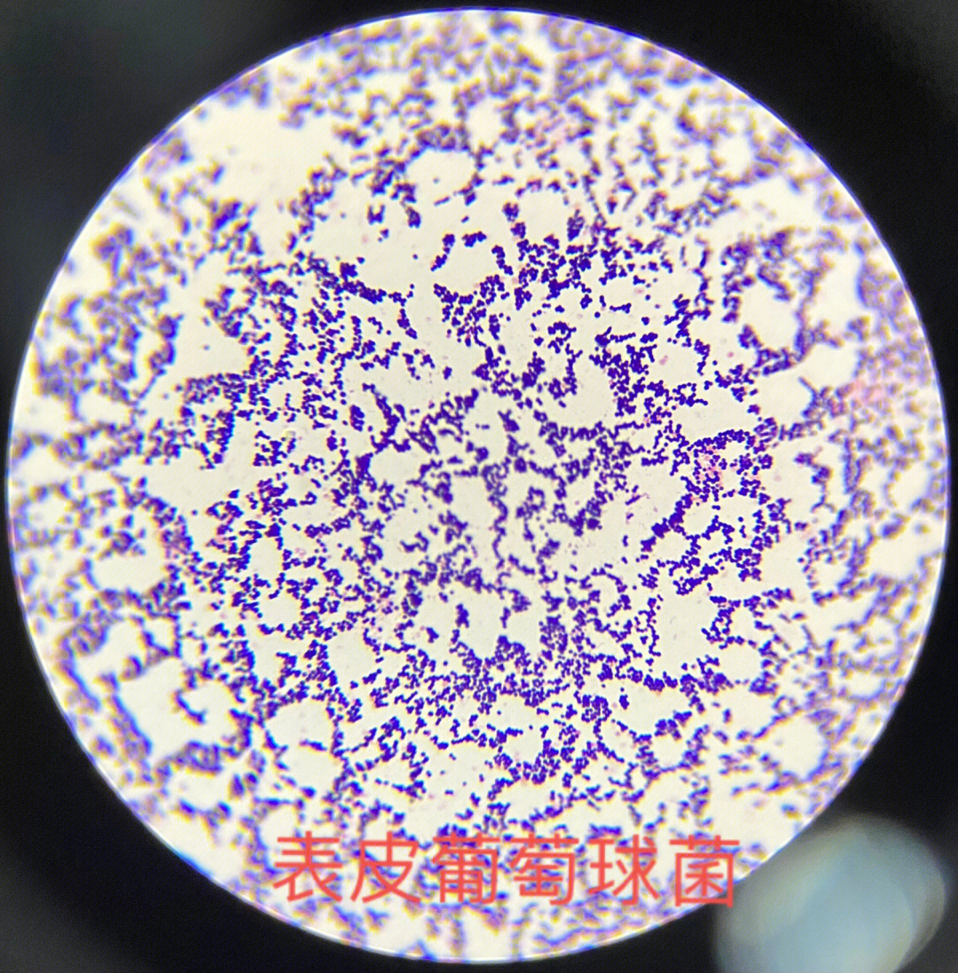 表皮葡萄球菌表面图片