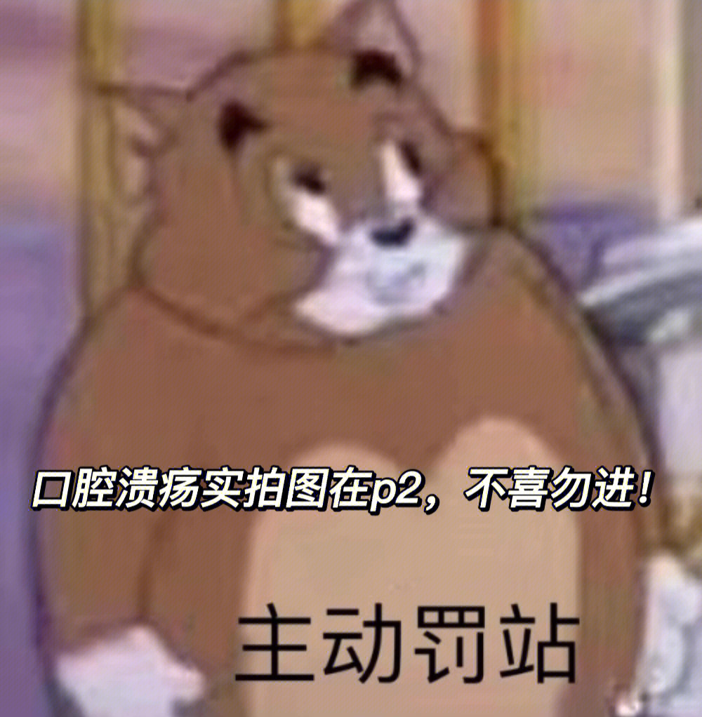 口腔溃疡表情包图片