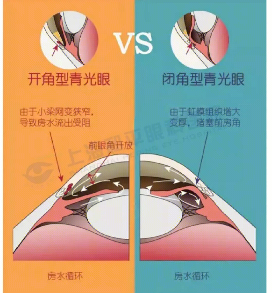 睫状肌收缩原理图片