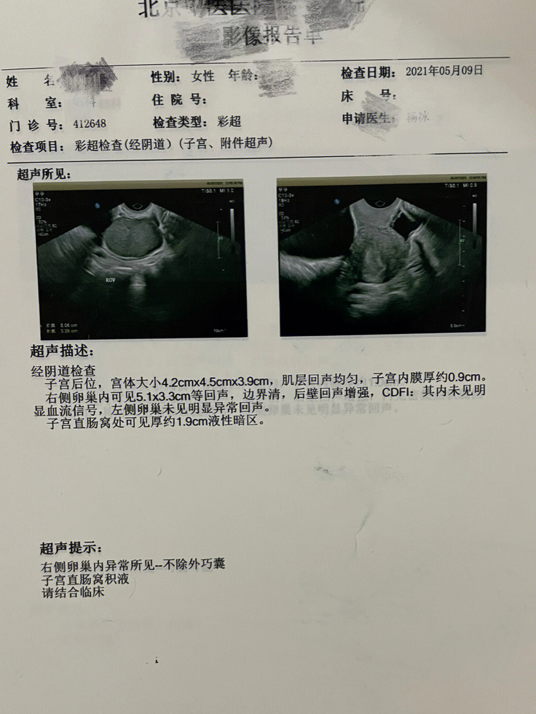 21年5月体检时突然被医生告知卵巢有一个囊肿03在此之前的体检一直