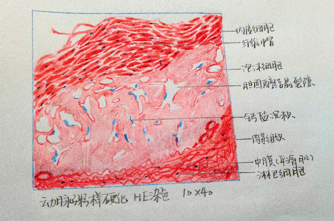 神经元的红蓝铅笔图图片