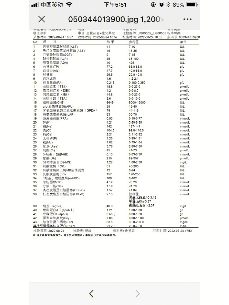 干燥综合症能活多久图片