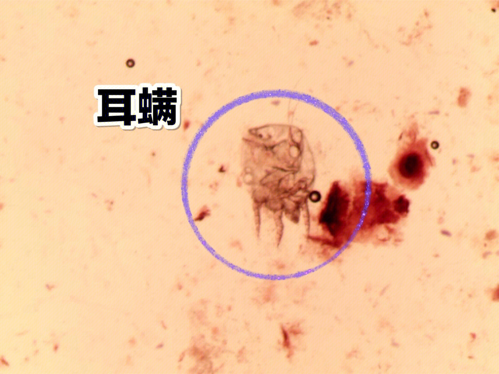 耳螨镜检图片图片