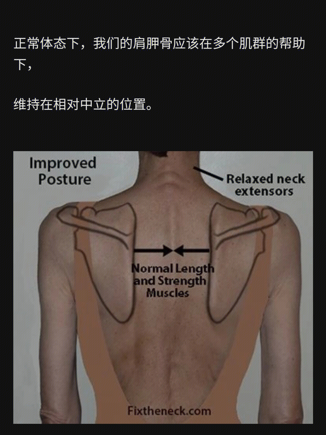 翼状肩和正常肩膀图片图片