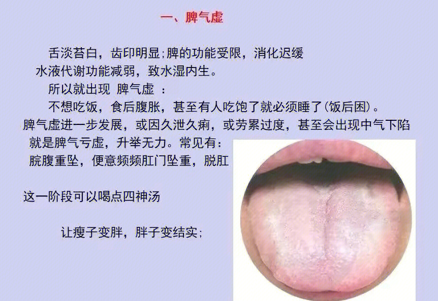 脾胃虚弱舌苔症状图图片