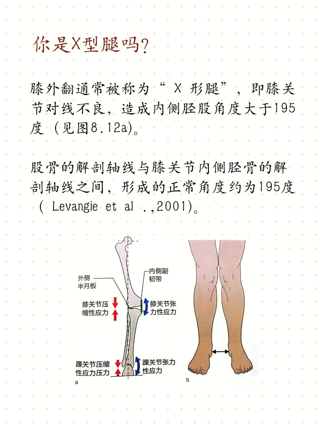 x型腿严重程度判断图图片