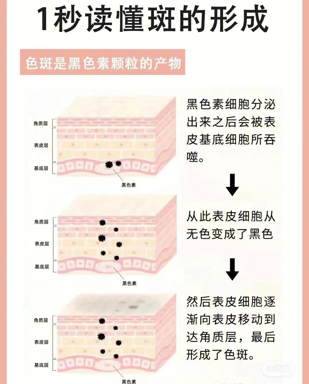 蝴蝶斑的形成原因图片图片