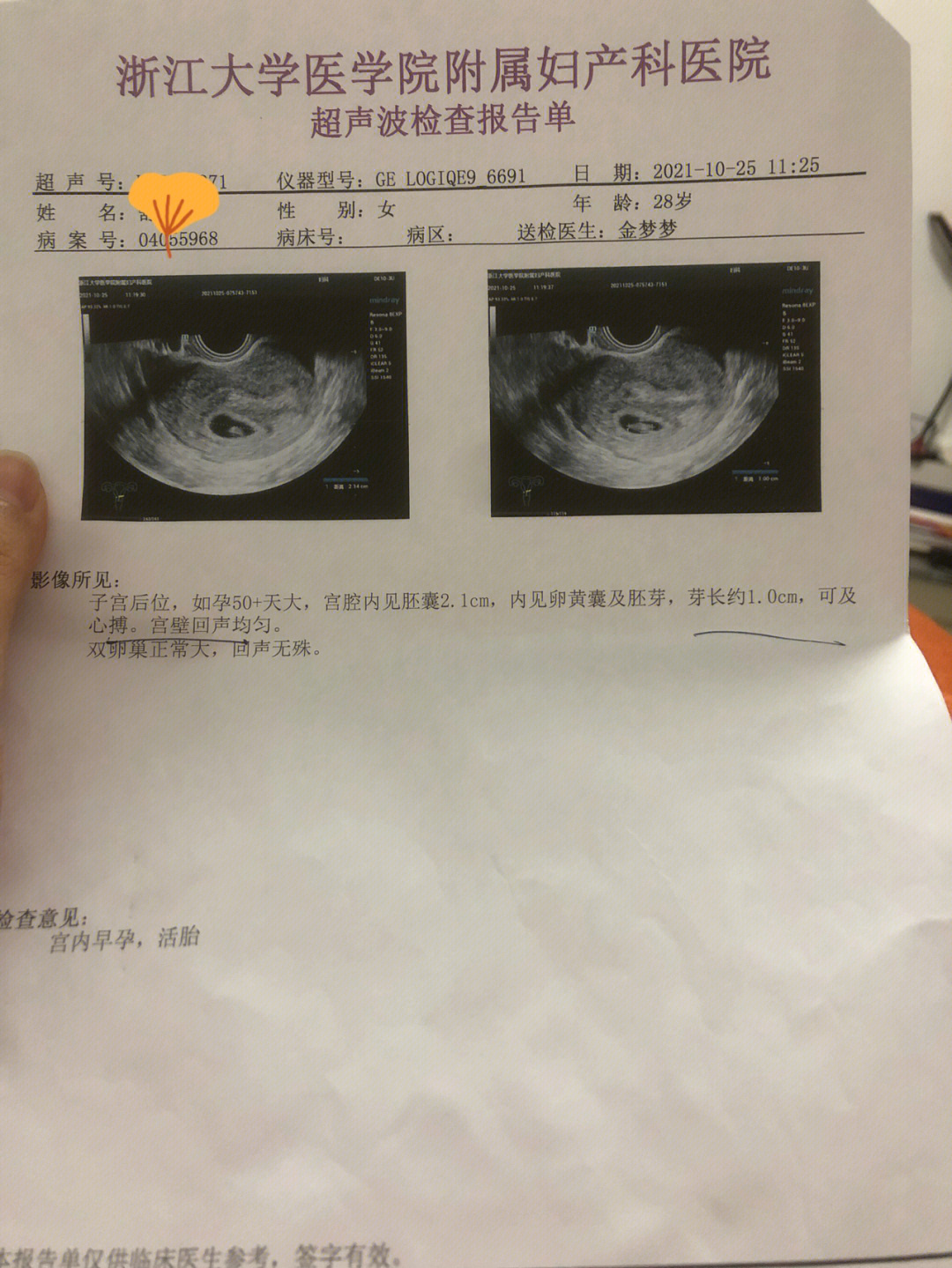 怀孕两周图片图片
