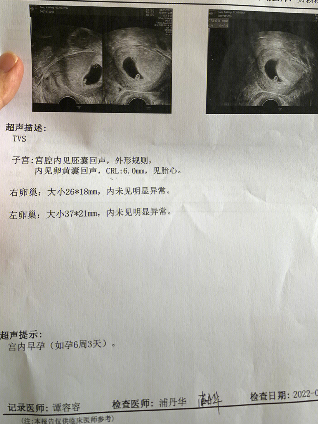 胎心胎芽几周能查出来图片