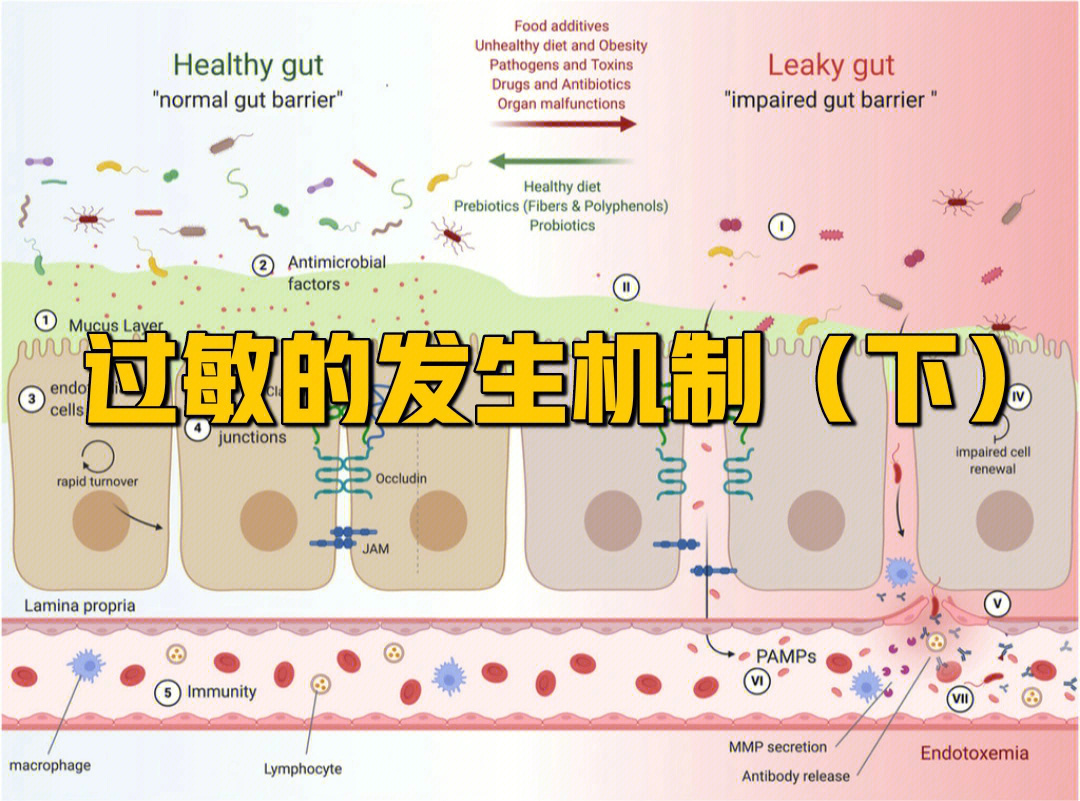 过敏的发生机制下