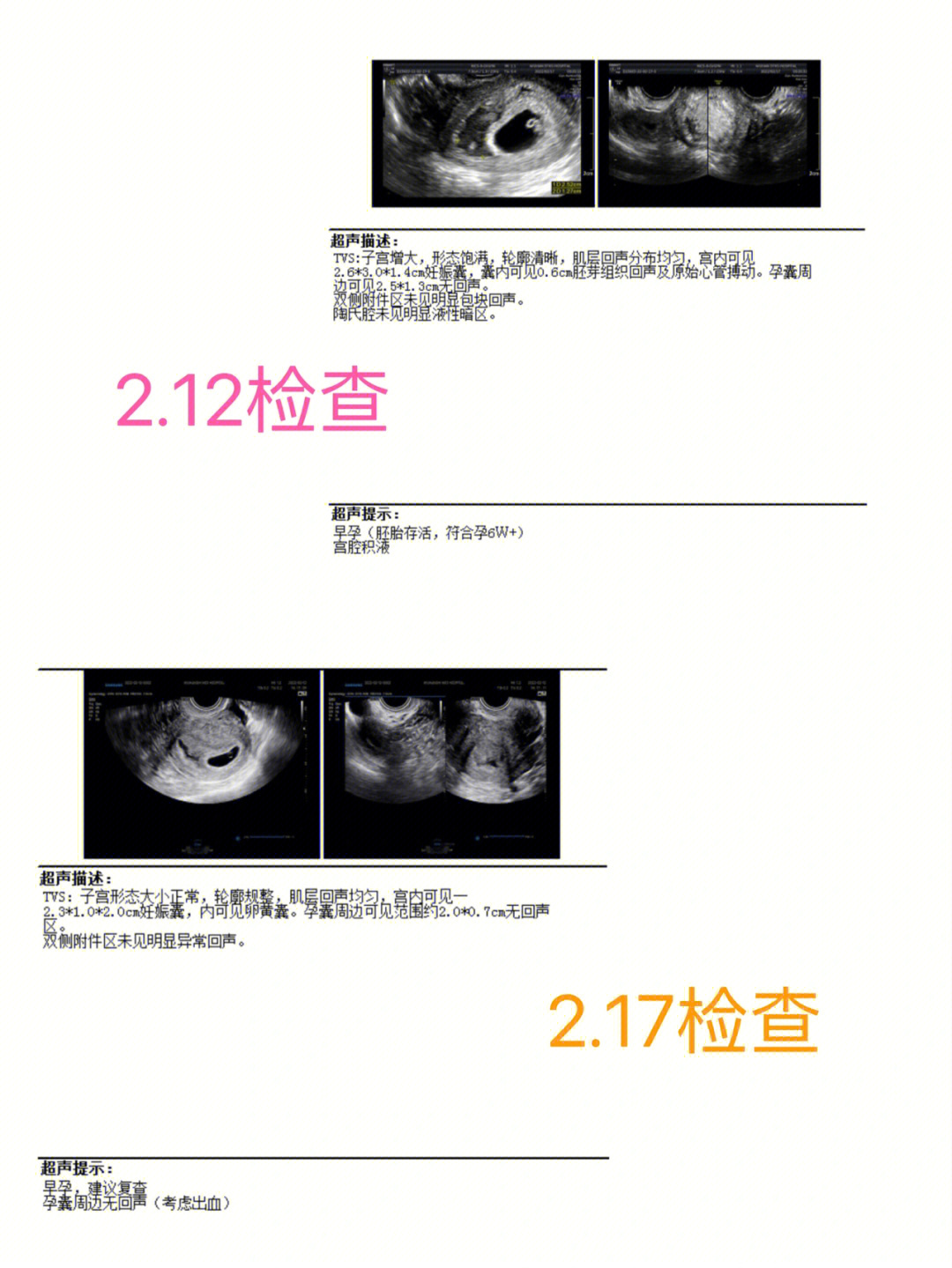 睾丸活检报告图片