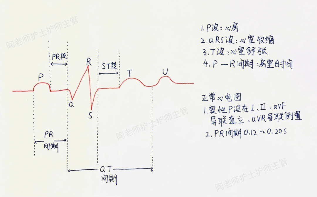 看心电图的简易看法图片