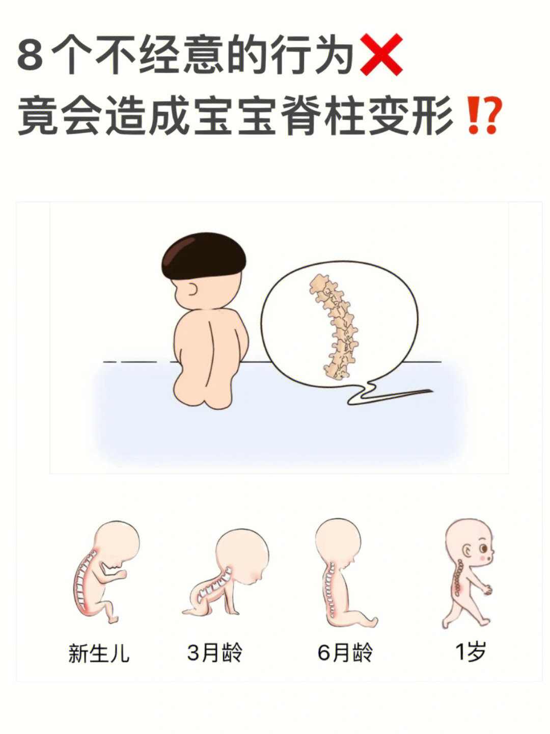 婴儿竖抱脊柱弯曲图图片