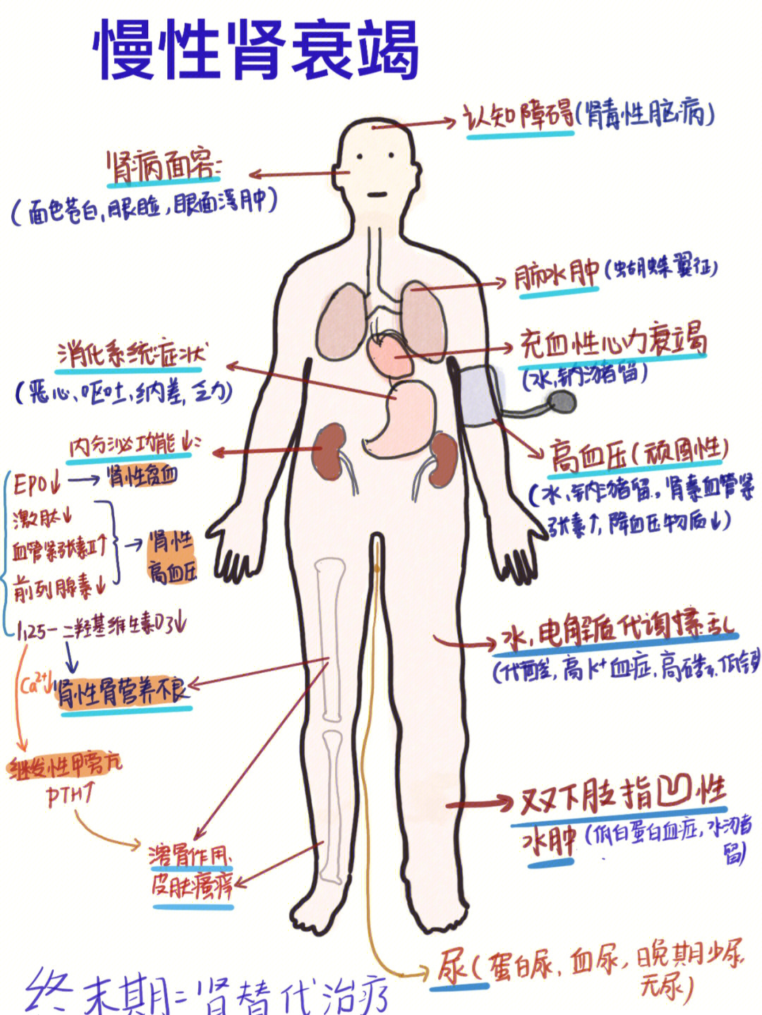 肾衰竭分期图片