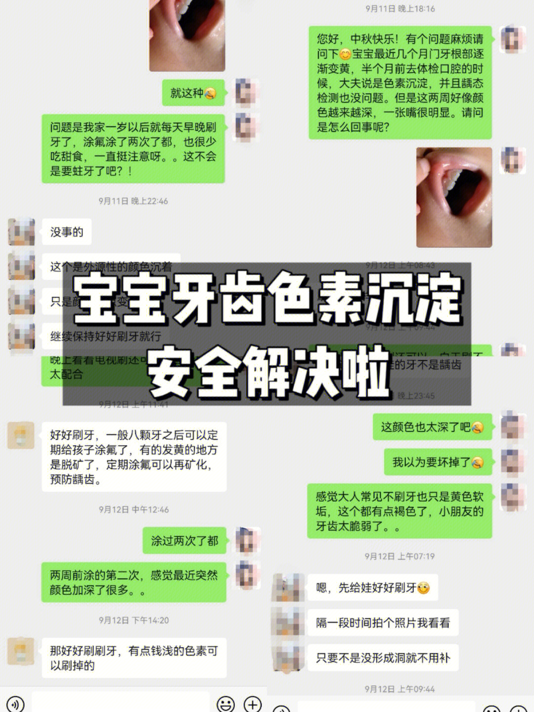 牙齿色素沉淀怎么去除图片