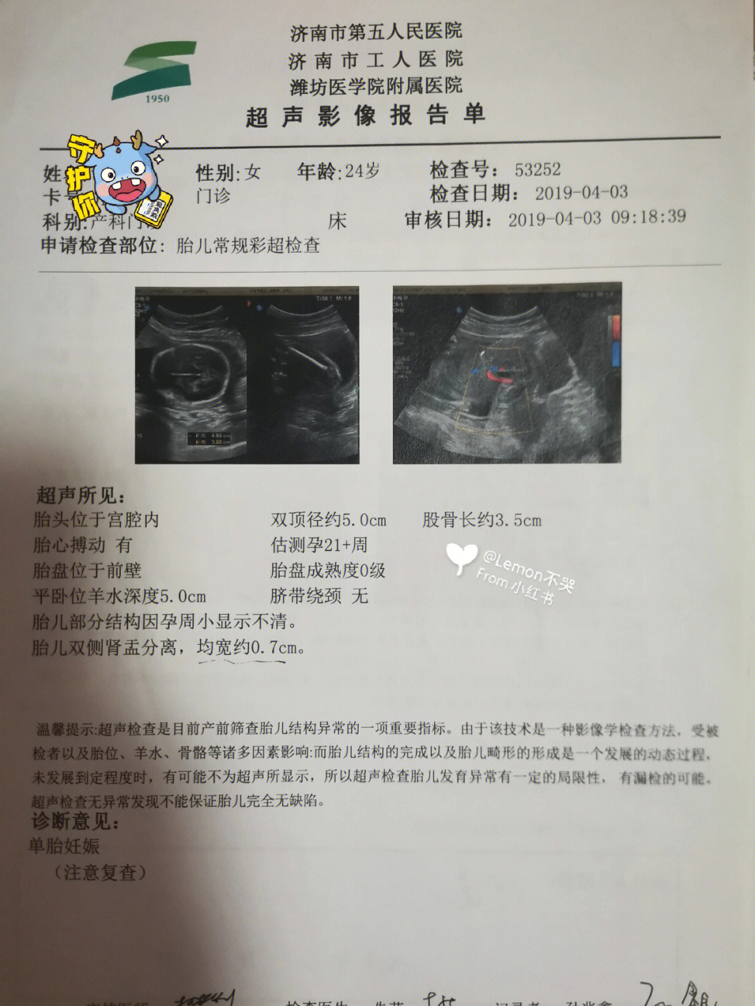 双肾盂分离图片图片