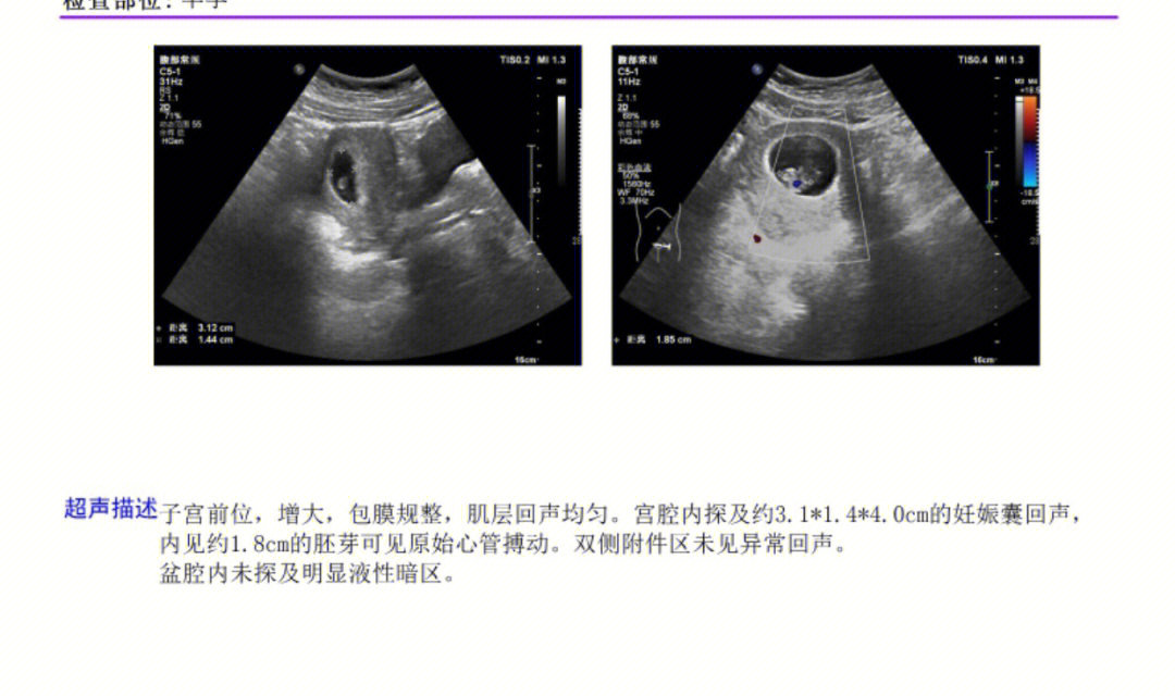 9周子宫位置图图片