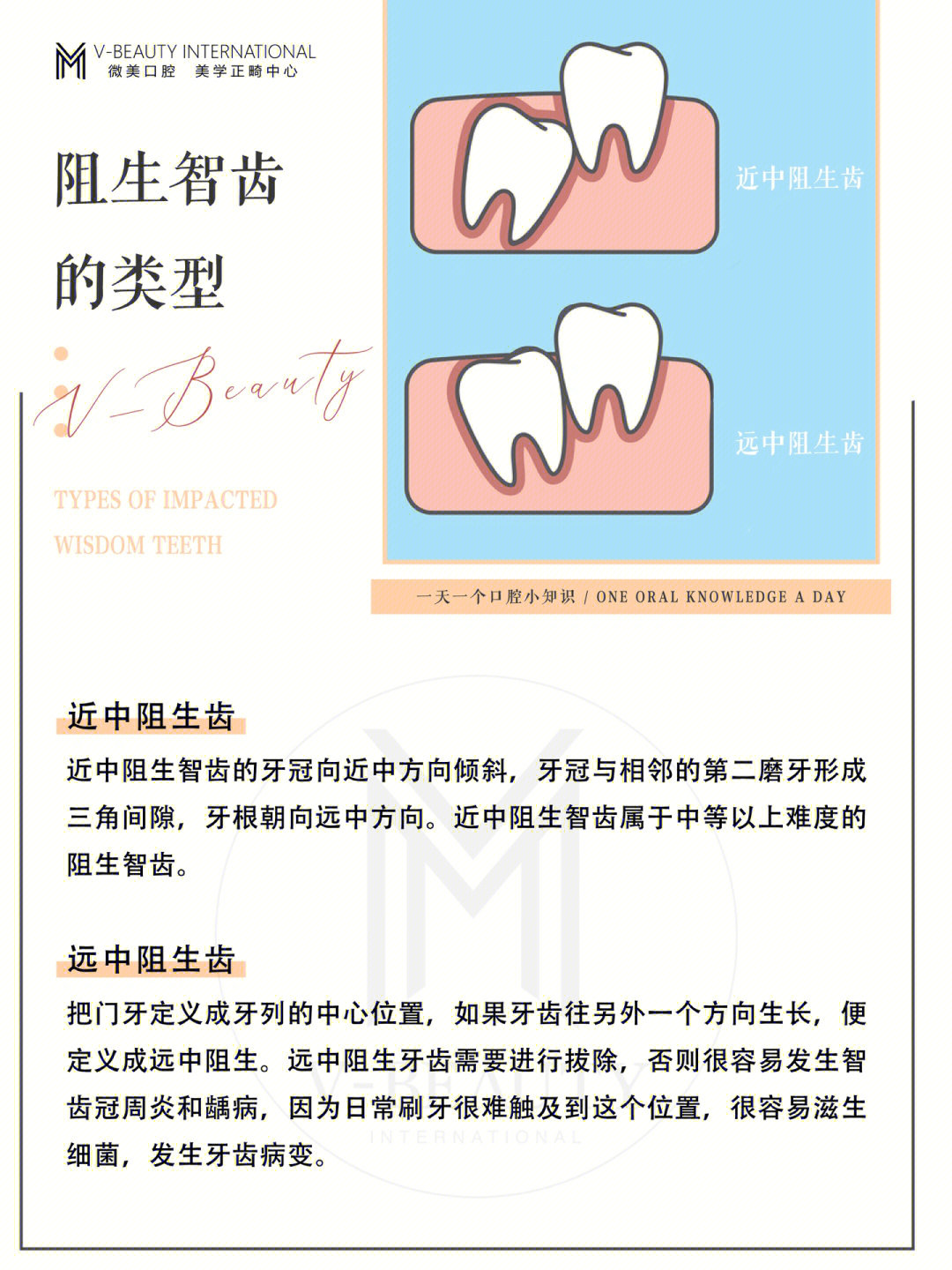 阻生齿类型图片