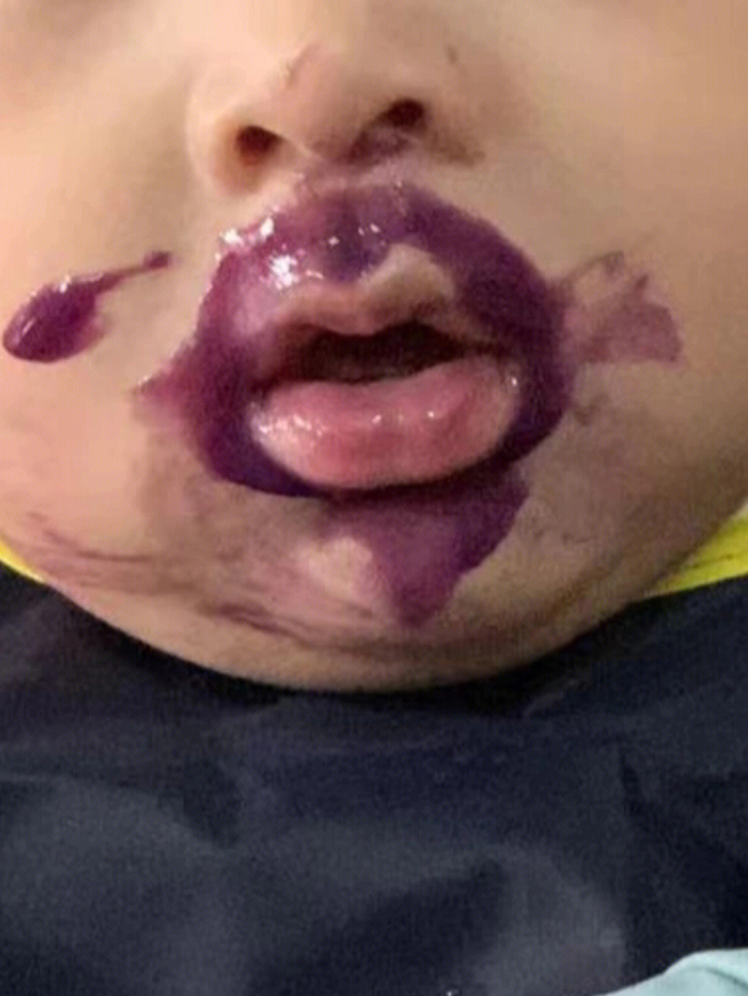 小孩嘴巴周围发紫图片图片