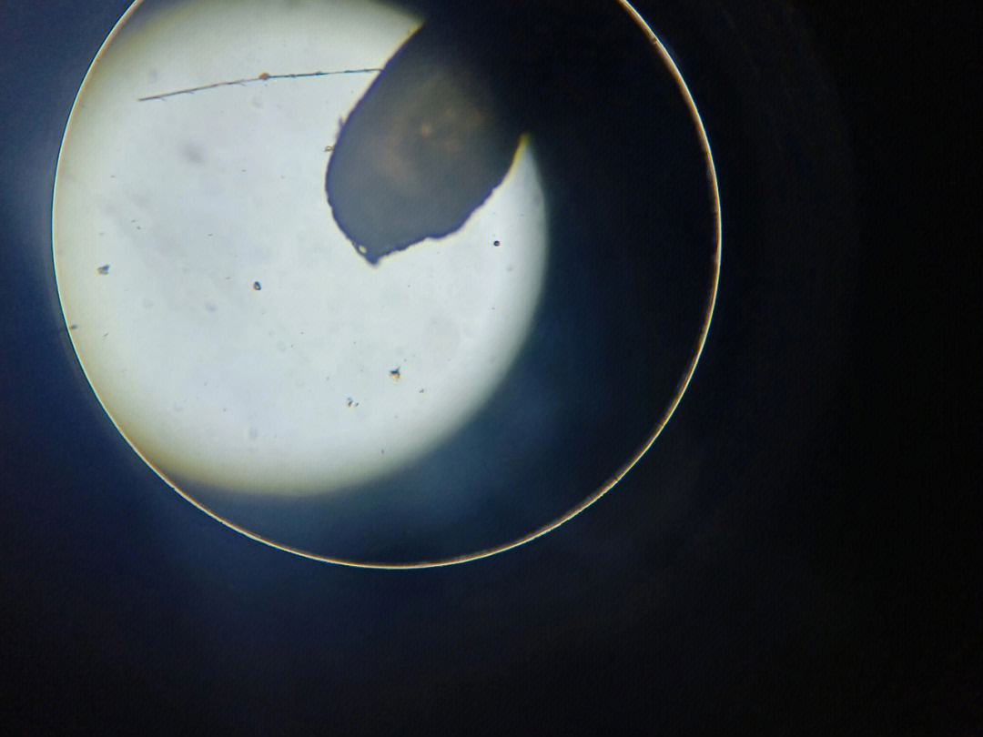 显微镜下的皮肤 黑头图片