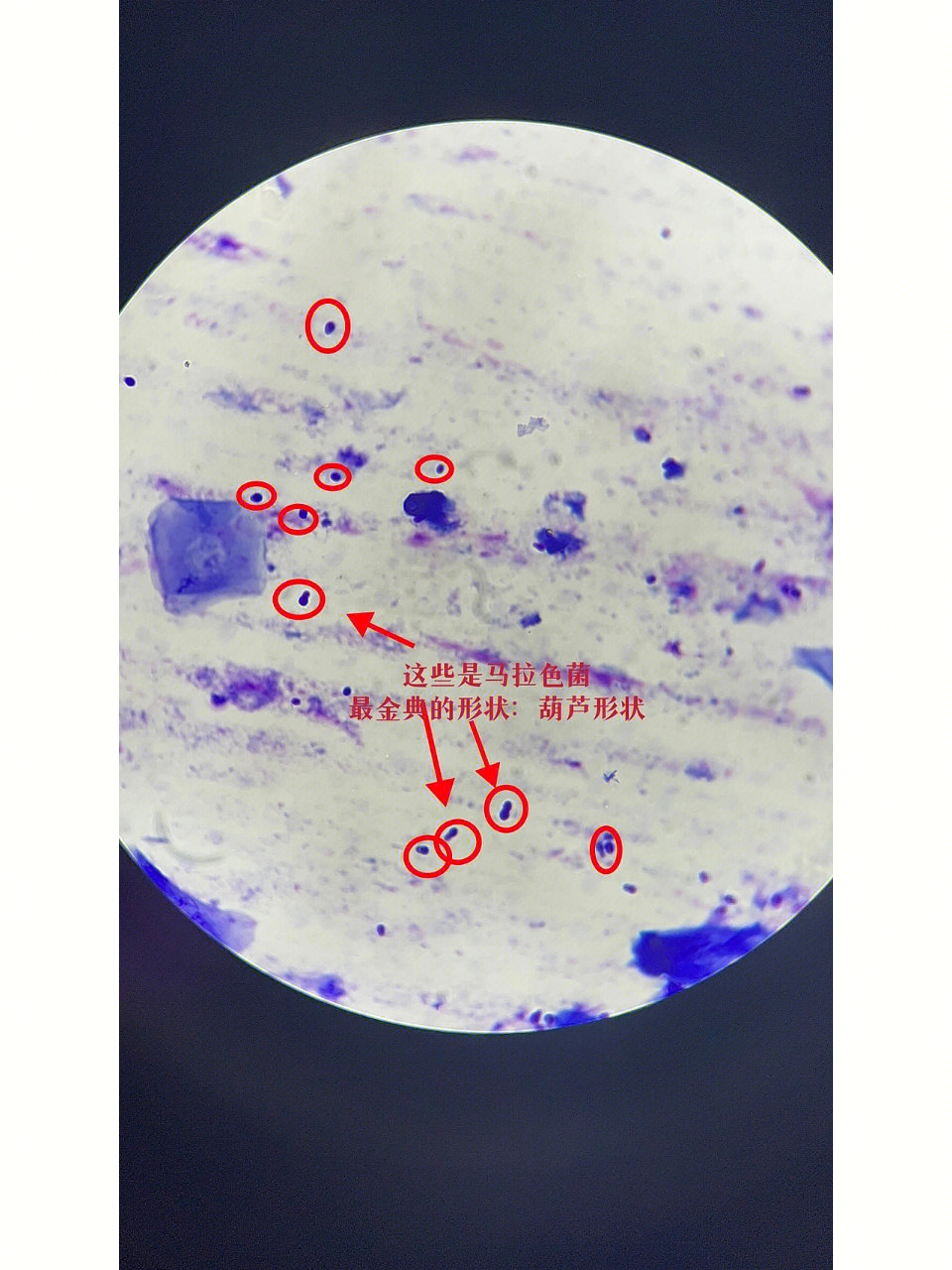 猫真菌显微镜图片图片