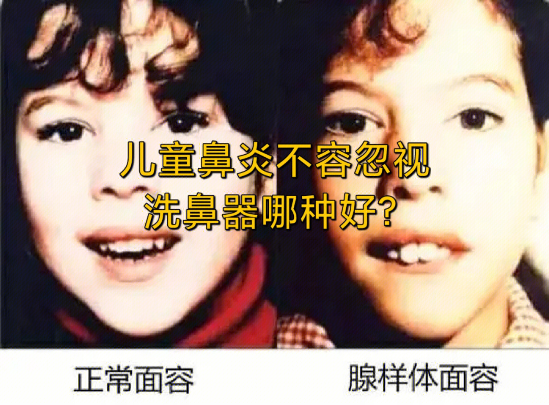 小孩鼻子鼻窦炎照片图片