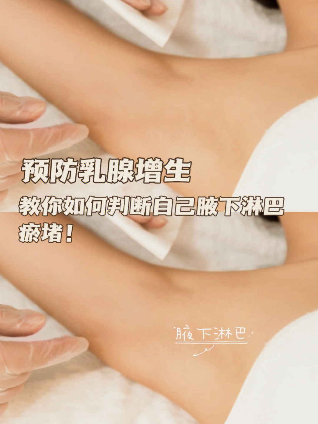 自己怎么判断乳腺增生图片