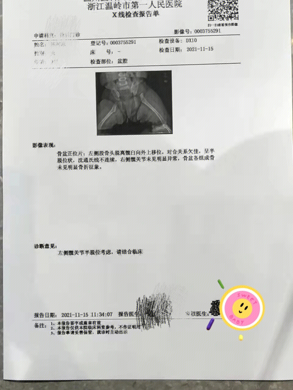 肠梗阻x线报告模板图片