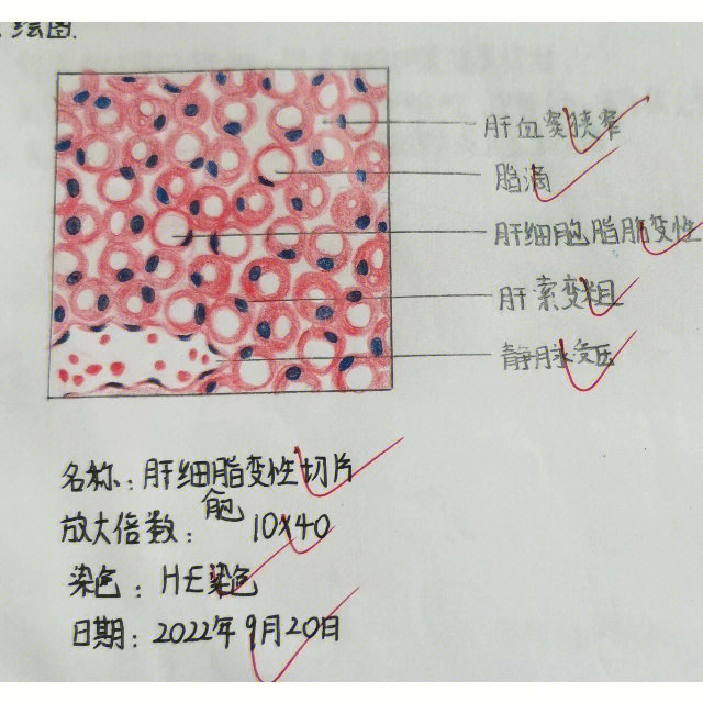 病理学红蓝铅笔绘图1