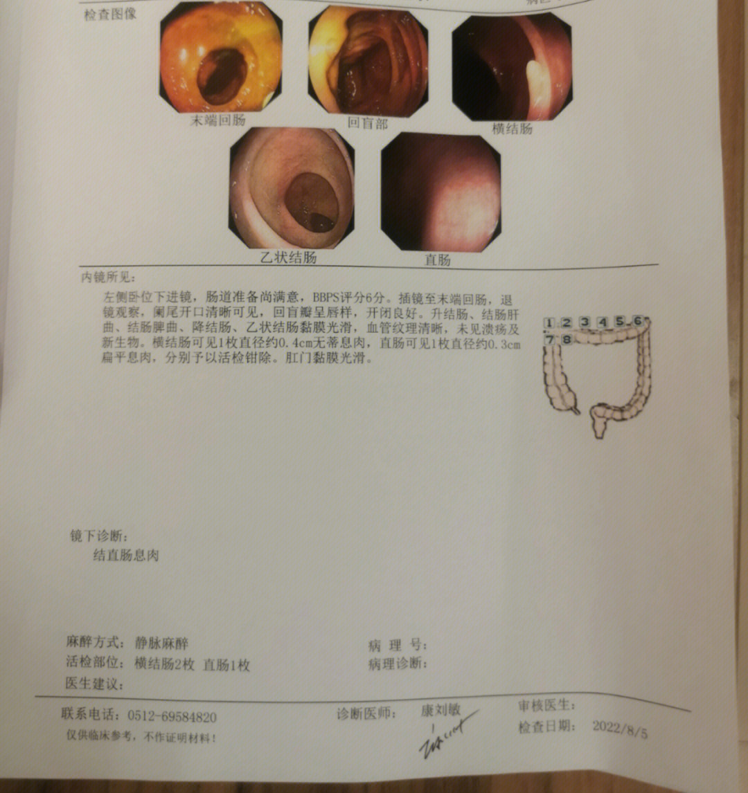 肠镜病理报告图片